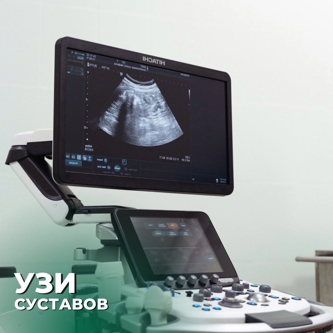Врач назначил УЗИ суставов? Давайте разберемся, в каких случаях его назначают?